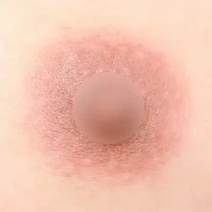 乳頭乳輪カラー AFTER