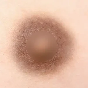 乳頭乳輪カラー BEFORE