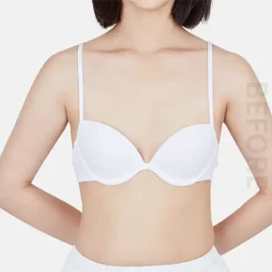 シリコンバック豊胸 BEFORE
